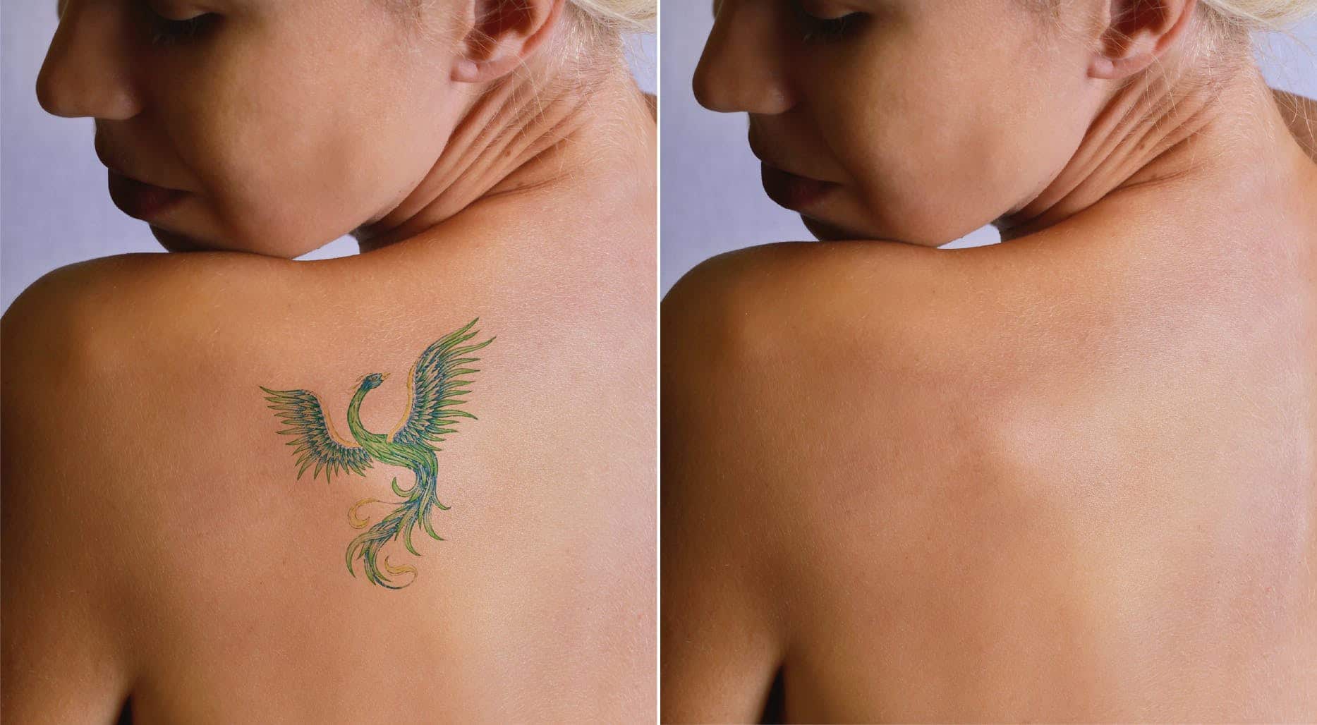 Comment faire disparaître votre tatouage temporaire ? Comment faire disparaître votre tatouage temporaire ?